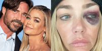 Denise Richards acusa ex-marido Aaron Phypers de agress&atilde;o  Foto: Reprodu&ccedil;&atilde;o/Instagram @aaronwilliamcameron e Reprodu&ccedil;&atilde;o/Fox News via Superior Court of California 