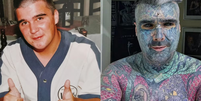 Antes e depois de Matthew Whelan, também conhecido como King of Inkland King Body Art  Foto: Reprodução/Jam Press/@kingofinklandkingbodyart)