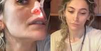 Paris Jackson mostra sequela do uso de drogas Foto: Reprodução/Redes sociais