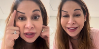 Maíra Cardi fica com sobrancelha torta após botox dar errado  Foto: Reprodução/TikTok