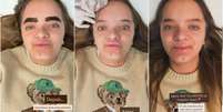 Rafa Justus mostra antes e depois de procedimento nas sobrancelhas  Foto: Reprodução/{Instagram