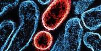 Colorised transmission electron micrograph of mature extracellular Nipah virus particles (red) near the periphery of an infected VERO cell (blue)  Foto: Universal Images Group/Getty Images / BBC News Brasil