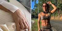 Fl&aacute;via Bueno, de 35 anos, teve les&atilde;o medular grave no R&eacute;veillon e conseguiu na Justi&ccedil;a autoriza&ccedil;&atilde;o para uso da polilaminina  Foto: Reprodu&ccedil;&atilde;o/Instagram