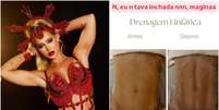 Virginia mostra antes e depois do abd&ocirc;men ap&oacute;s drenagem linf&aacute;tica  Foto: Reprodu&ccedil;&atilde;o/Instagram