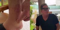 Leonardo diverte a web ao culpar 'cacha&ccedil;a' por p&eacute; inchado e d&aacute; resposta sincerona a Poliana  Foto: Reprodu&ccedil;&atilde;o/Instagram / Contigo