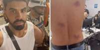 Jo&atilde;o Vitor sendo conduzido por policiais | Imagem do exame de corpo de delito  Foto: Imagens concedidas ao Terra