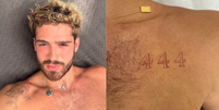 Jo&atilde;o Guilherme passa por remo&ccedil;&atilde;o de tatuagens com tratamento a laser  Foto: Reprodu&ccedil;&atilde;o: Redes Sociais / Sa&uacute;de em Dia