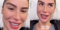 Bianca Andrade revela tensão antes de fazer transplante de sobrancelha: 'Acordar feia' / Reprodução: Instagram  Foto: Contigo
