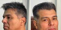 Maur&iacute;cio Mattar, antes e depois  Foto: Reprodu&ccedil;&atilde;o | Instagram