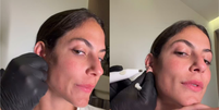 Mari Gonzalez faz procedimento para fechar orelha rasgada  Foto: Reprodução/Instagram