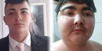 Duas fotos do adolescente Gustavo de Oliveira: a primeira, &agrave; esquerda, &eacute; de mar&ccedil;o de 2024; a segunda, &agrave; direita, &eacute; de dezembro de 2025 Foto: Arquivo pessoal / BBC News Brasil