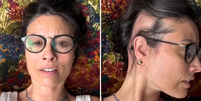 Ex-apresentadora britânica Melanie Sykes, de 55 anos, comoveu seguidores ao compartilhar um vídeo nas redes sociais em que mostra a perda de cabelo causada pela alopecia  Foto: Reprodução/Instagram