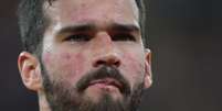 O que é a vermelhidão no rosto de Alisson Becker, o goleiro do Brasil na Copa 2026? Doença crônica não tem cura, aponta médica especialista - na foto, jogador durante a Copa 2018.  Foto: Lucas Figueiredo/CBF / Purepeople