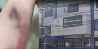 Crian&ccedil;a levou 13 pontos no bra&ccedil;o ap&oacute;s incidente  Foto: Montagem: Reprodu&ccedil;&atilde;o e Google Street View