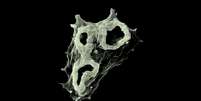 Naegleria fowleri, mais conhecida como a 'ameba comedora de c&eacute;rebros', ataca o tecido cerebral Foto: Bruno da Rocha-Azevedo, Herbert B. Tanowitz e Francine Marciano-Cabral / Interdisciplinary Perspectives on Infectious Diseases / BBC News Brasil