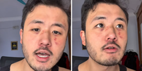 Ricardo Akira foi agredido por desconhecido em vagão de metrô em SP  Foto: Reprodução