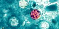 Parasita microsc&oacute;pico 'Cyclospora cayetanensis' provoca diarreia 'explosiva', que &eacute; aquosa e com evacua&ccedil;&otilde;es frequentes Foto: Divulga&ccedil;&atilde;o/CDC/DPDx/Melanie Moser