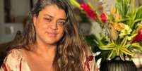 Foto: Reprodu&ccedil;&atilde;o/Instagram  Foto: Sa&uacute;de em Dia