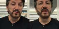 Lito Sousa está internado em São Paulo após descobrir inflamação no sistema nervoso central   Foto: Reprodução/Instagram / Flipar