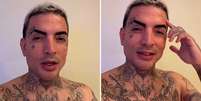 MC Guim&ecirc; responde a coment&aacute;rios de seguidores que criticaram suas tatuagens no rosto.  Foto: Reprodu&ccedil;&atilde;o/ Redes Sociais