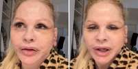 Monique Evans teve problemas com reconhecimento facial de banco após realizar cirurgia  Foto: Reprodução/Instagram