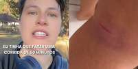 Corredora diz que tomou rasteira de dois homens em parque de São Paulo  Foto: Reprodução/TikTok/@atletadefimdesemana