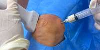 O especialista explica que o tratamento &eacute; indicado principalmente para pacientes com doen&ccedil;as degenerativas articulares Foto: Divulga&ccedil;&atilde;o / Perfil Brasil