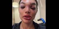 A cirurgi&atilde;-dentista Giullia Falc&atilde;o afirma ter sido agredida pelo marido, o empres&aacute;rio Ivo Kos, que foi preso. Foto: Reprodu&ccedil;&atilde;o/@dragiufalcao via TikTok / Estad&atilde;o