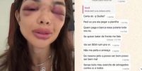 Esposa divulga mensagens de amea&ccedil;a de empres&aacute;rio preso por agress&atilde;o em SP: 'Posso ser bem mal'  Foto: Reprodu&ccedil;&atilde;o/Instagram:@dragiufalcaokos
