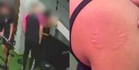 Aluna denunciou ass&eacute;dio ap&oacute;s ser agarrada e mordida por instrutor em academia da Zona Norte do Recife  Foto: Reprodu&ccedil;&atilde;o/Redes sociais 