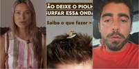 Discuss&atilde;o entre Luana Piovani e Pedro Scooby sobre origem dos piolhos da filha vira assunto na Secretaria de Sa&uacute;de do Rio  Foto: Reprodu&ccedil;&atilde;o/Instagram