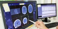 Close-up de uma m&eacute;dica analisando o laudo de uma tomografia computadorizada em um monitor de computador  Foto: Getty Images / BBC News Brasil