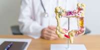 Veja os perigos dos p&oacute;lipos intestinais  Foto: Shutterstock / Sa&uacute;de em Dia