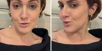 Mila explica magreza aos seguidores  Foto: Reprodu&ccedil;&atilde;o Instagram | @milaseidl
