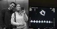 Em uma publica&ccedil;&atilde;o nas redes sociais, Niina afirmou que n&atilde;o sabia se falaria sobre o assunto ou como abordaria a perda  Foto: Reprodu&ccedil;&atilde;o/Instagram/@niinasecrets