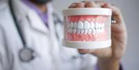 Aprenda a limpar a sua pr&oacute;tese dent&aacute;ria de forma segura. Descubra os produtos recomendados, o que evitar e como prolongar a durabilidade Foto: Canva Equipes/Towfiqu barbhuiya de Pexels / Bons Fluidos