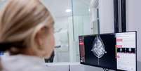 Intelig&ecirc;ncia artificial pode ajudar na detec&ccedil;&atilde;o de c&acirc;ncer de mama  Foto: FG Trade/