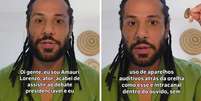 Ator Amaury Lorenzo fala sobre defici&ecirc;ncia gradativa e critica Fl&aacute;vio Bolsonaro Foto: Reprodu&ccedil;&atilde;o Instagram | @amaurylorenzo