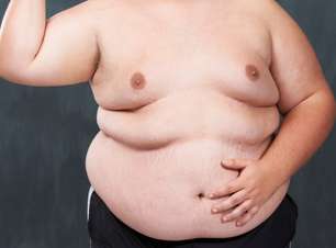 Um terço dos jovens obesos não se considera acima do peso