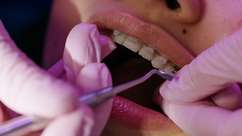 Como se tratavam os dentes antes dos dentistas?