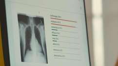 Startup cria algoritmo que detecta covid-19 com raio-x