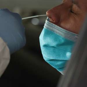 Ministério da Saúde tem 9,5 milhões de testes estocados