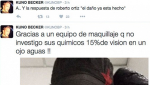 Kuno Becker casi pierde la vista por maquillaje corriente