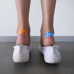 Cuidado com calçado evita que bolhas estraguem o Carnaval