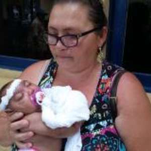 Tia adota sobrinha que foi abandonada com microcefalia