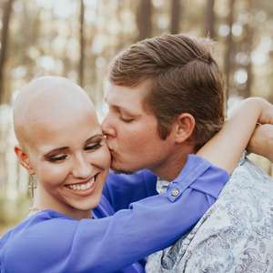 A mulher que tirou a peruca e decidiu assumir alopecia ...