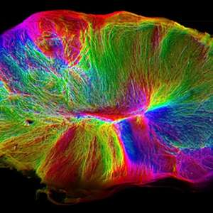 Cientistas cultivam "minicérebro" que pode contrair músculos