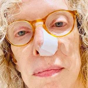 Marília Gabriela descobre câncer de pele e passa por ...