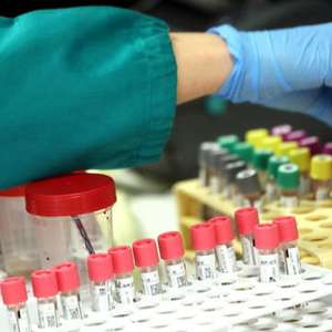 Cortes em bolsas afetam pesquisa sobre o novo coronavírus