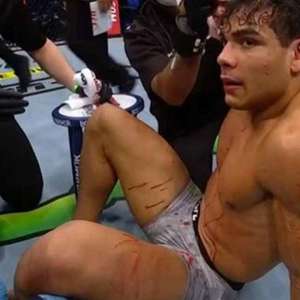 Brasileiro diz que "estava meio bêbado" em luta do cinturão